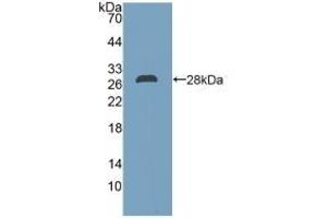 Detection of Recombinant DDAH2, Human using Polyclonal Antibody to Dimethylarginine Dimethylaminohydrolase 2 (DDAH2) (DDAH2 Antikörper  (AA 31-265))