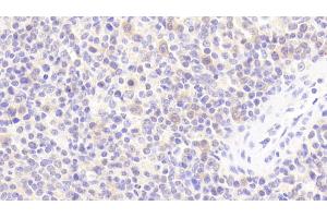 Immunohistochemistry (IHC) image for anti-Interleukin 1 Receptor Antagonist (IL1RN) (AA 26-177) antibody (ABIN7431371)