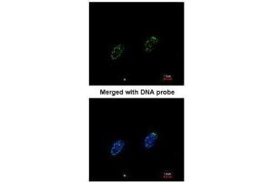 ICC/IF Image Immunofluorescence analysis of paraformaldehyde-fixed HeLa, using RPA 70 kDa subunit , antibody at 1:200 dilution. (RPA1 Antikörper  (C-Term))