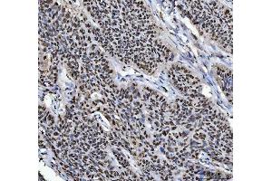 IHC analysis of HNRNPL using anti-HNRNPL antibody (ABIN4886624). (HNRNPL Antikörper  (C-Term))