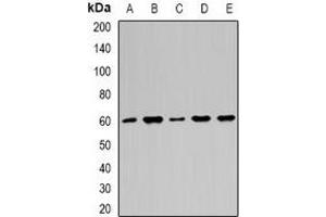 Western blot analysis of Importin alpha 1 expression in HepG2 (A), Hela (B), A549 (C), mouse brain (D), mouse heart (E) whole cell lysates. (KPNA2 Antikörper)