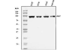 Western blot analysis of B Raf/BRAF using anti-B Raf/BRAF antibody (ABIN3043761). (BRAF Antikörper  (AA 38-230))