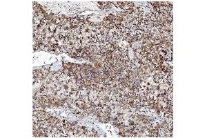 IHC analysis of VAPB using anti-VAPB antibody (ABIN5693292). (VAPB Antikörper  (AA 2-55))