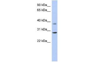 WB Suggested Anti-HOXC5 Antibody Titration:  0.