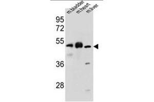 BTBD17 Antibody (C-term) western blot analysis in mouse bladder,heart,liver tissue lysates (35µg/lane). (BTBD17 Antikörper  (C-Term))