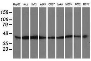 Image no. 2 for anti-ATG3 Autophagy Related 3 (ATG3) antibody (ABIN1496761)