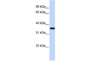WB Suggested Anti-VGLL3 Antibody Titration: 0. (VGLL3 Antikörper  (Middle Region))
