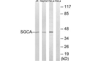 Western Blotting (WB) image for anti-Sarcoglycan, alpha (50kDa Dystrophin-Associated Glycoprotein) (SGCA) (Internal Region) antibody (ABIN1850735) (SGCA Antikörper  (Internal Region))