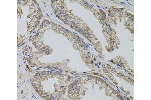 Immunohistochemistry of paraffin-embedded Human prostate using VIP Polyclonal Antibody (Vip Antikörper)