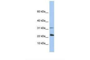 Image no. 1 for anti-Exosome Component 3 (EXOSC3) (C-Term) antibody (ABIN6737903) (EXOSC3 Antikörper  (C-Term))