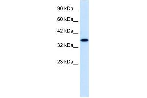 WB Suggested Anti-ZNF75 Antibody Titration:  1. (ZNF75 Antikörper  (Middle Region))
