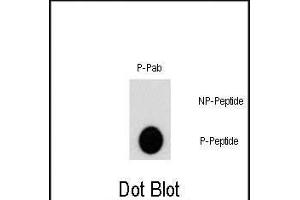 Dot blot analysis of Phospho-AKT2- polyclonal antibody (ABIN389734 and ABIN2839673) on nitrocellulose membrane. (AKT2 Antikörper  (pSer474))
