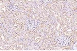 Immunohistochemistry analysis of paraffin-embedded rat kidney using,CTSV (ABIN7073348) at dilution of 1: 2000 (Cathepsin L2 Antikörper)