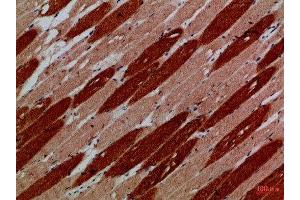 Immunohistochemical analysis of paraffin-embedded Human-skeletal-muscle, antibody was diluted at 1:100 (MYH6 Antikörper)