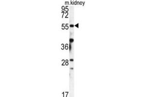 Western Blotting (WB) image for anti-FK506 Binding Protein 9, 63 KDa (FKBP9) antibody (ABIN3003182) (FKBP9 Antikörper)