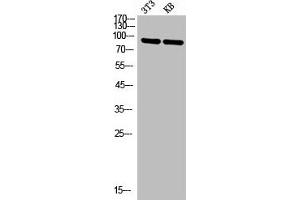 Western Blot analysis of NIH-3T3 KB cells using P-Selectin Polyclonal Antibody (P-Selectin Antikörper  (N-Term))