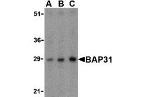 Western Blotting (WB) image for anti-B-Cell Receptor-Associated Protein 31 (BCAP31) (Middle Region) antibody (ABIN1030882) (BCAP31 Antikörper  (Middle Region))