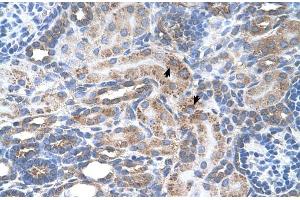Human kidney (SLC29A2 Antikörper  (N-Term))