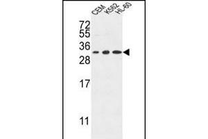 TSN2 Antibody (Center) (ABIN653269 and ABIN2842786) western blot analysis in CEM,K562,HL-60 cell line lysates (35 μg/lane). (Tetraspanin 2 Antikörper  (AA 109-137))
