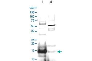 Western blot using UBE2N polyclonal antibody  shows detection of UBE2N protein inhuman small intestine lysate (Lane 1), but not in mouse thymus lysate (Lane 2). (UBE2N Antikörper  (AA 40-51))