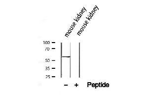Western blot analysis of extracts from mouse kidney, using SLC13A2 antibody. (SLC13A2 Antikörper)