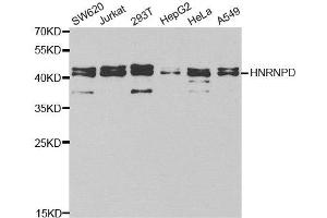 Western Blotting (WB) image for anti-Heterogeneous Nuclear Ribonucleoprotein D (HNRNPD) antibody (ABIN1876913) (HNRNPD/AUF1 Antikörper)