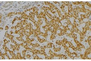 ABIN6276571 at 1/100 staining Mouse liver tissue by IHC-P. (GAS2 Antikörper  (C-Term))