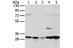 Western Blot analysis of 293T and MCF7 cell, Mouse brain tissue and K562 cell, Mouse bladder tissue using TPD54 Polyclonal Antibody at dilution of 1:400