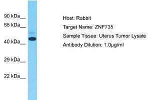 Host: Rabbit Target Name: ZNF735 Sample Type: Uterus Tumor lysates Antibody Dilution: 1.