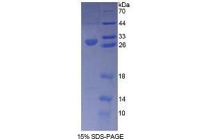 SDS-PAGE analysis of Human RXRg Protein.