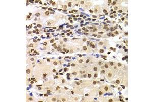 Immunohistochemistry of paraffin-embedded human stomach using HMGB1 Antibody. (HMGB1 Antikörper  (AA 100-200))