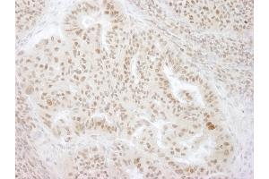 Immunohistochemistry (IHC) image for anti-Kinesin Family Member C1 (KIFC1) (AA 625-673) antibody (ABIN7448624) (KIFC1 Antikörper  (AA 625-673))