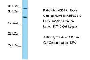 Western Blotting (WB) image for anti-CD6 (CD6) (C-Term) antibody (ABIN2789458) (CD6 Antikörper  (C-Term))