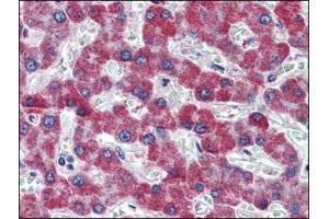 Human Liver: Formalin-Fixed, Paraffin-Embedded (FFPE) (PAR1 Antikörper  (Internal Region))