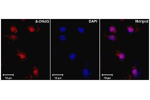 Immunohistochemistry analysis using Mouse Anti-DNA Damage Monoclonal Antibody, Clone 15A3 . (DNA/RNA Damage Antikörper (PerCP))