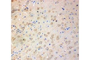 IHC-P: SOD2 antibody testing of rat brain tissue (SOD2 Antikörper  (N-Term))