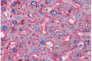 Human Liver (formalin-fixed, paraffin-embedded) stained with APOB antibody ABIN337314 at 5 ug/ml followed by biotinylated anti-goat IgG secondary antibody ABIN481715, alkaline phosphatase-streptavidin and chromogen. (APOB Antikörper)