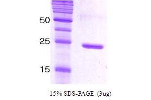 SDS-PAGE (SDS) image for Synaptosomal-Associated Protein, 25kDa (SNAP25) protein (ABIN666820) (SNAP25 Protein)
