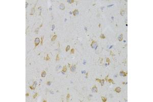 Immunohistochemistry of paraffin-embedded mouse brain using KISS1R Antibody (ABIN3017091, ABIN3017092, ABIN3017093 and ABIN6219946) at dilution of 1:100 (40x lens). (KISS1R Antikörper)