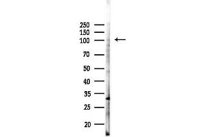 anti-Ribosome Binding Protein 1 (RRBP1) antibody