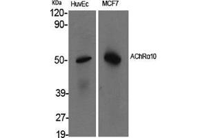 Western Blot (WB) analysis of specific cells using AChRalpha10 Polyclonal Antibody. (CHRNA10 Antikörper  (C-Term))