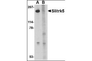 Western blot analysis of Slitrk5 in 3T3 cell lysate with this product at 1 μg/ml in the (A) absence or (B) presence of blocking peptide. (SLITRK5 Antikörper  (Center))