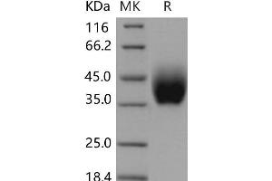 IL10RB Protein (His tag)