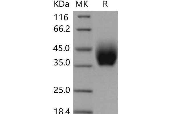 IL10RB Protein (His tag)