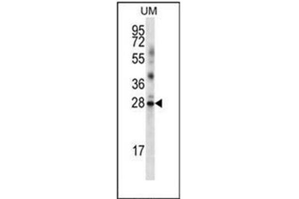 LRRN4CL Antikörper  (Middle Region)