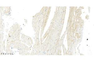 Immunohistochemistry (IHC) image for anti-Vascular Endothelial Growth Factor A (VEGFA) antibody (ABIN7662152)