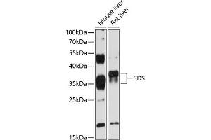 Western blot analysis of extracts of various cell lines, using SDS antibody (ABIN6132920, ABIN6147476, ABIN6147477 and ABIN6216699) at 1:3000 dilution. (serine Dehydratase Antikörper  (AA 90-170))