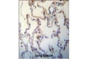 RAGE(AGER) Antibody (C-term) (ABIN389028 and ABIN2839245) immunohistochemistry analysis in formalin fixed and paraffin embedded human lung tissue followed by peroxidase conjugation of the secondary antibody and DAB staining.