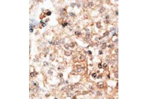 Image no. 2 for anti-Osteocalcin (BGLAP) (AA 9-39), (N-Term) antibody (ABIN357367) (Osteocalcin Antikörper  (N-Term))