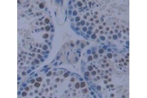 Used in DAB staining on fromalin fixed paraffin- embedded testis tissue (CSRP1 Antikörper  (AA 1-193))